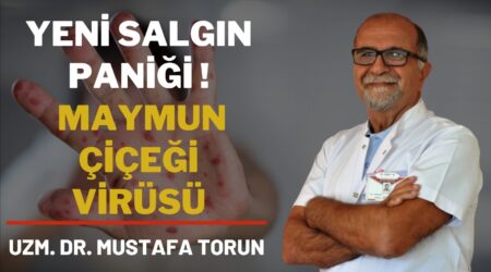 Yeni Salgın Paniği! Maymun Çiçeği Virüsü | Uzm. Dr. Mustafa Torun